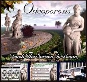 Osteoporosis
